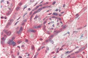 Human Placenta (formalin-fixed, paraffin-embedded) stained with FAIM antibody ABIN337178 at 2. (FAIM anticorps  (AA 121-132))