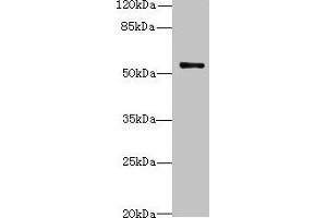 Western blot All lanes: TRIM38 antibody at 4 μg/mL + Jurkat whole cell lysate Secondary Goat polyclonal to rabbit IgG at 1/10000 dilution Predicted band size: 54 kDa Observed band size: 54 kDa (TRIM38 anticorps  (AA 45-259))