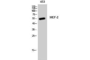 Western Blotting (WB) image for anti-Myelin Expression Factor 2 (MYEF2) (Ser89) antibody (ABIN6282557)