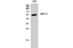 Western Blotting (WB) image for anti-Myelin Expression Factor 2 (MYEF2) (Ser89) antibody (ABIN3175957) (MYEF2 anticorps  (Ser89))