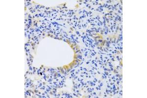 Immunohistochemistry of paraffin-embedded rat lung using MRPS30 Antibody (ABIN2563929) at dilution of 1:100 (40x lens). (MRPS30 anticorps)