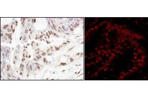 Immunohistochemistry (IHC) image for anti-Squamous Cell Carcinoma Antigen Recognized By T Cells 3 (SART3) (AA 600-650) antibody (ABIN7454757)