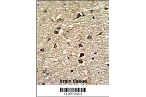 Formalin-fixed and paraffin-embedded human brain tissue reacted with XPO1 Antibody , which was peroxidase-conjugated to the secondary antibody, followed by DAB staining. (XPO1 anticorps  (C-Term))