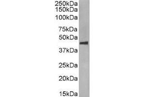Western Blot using anti-CCR5 (phosphoserine 349) antibody E11/19. (Recombinant CCR5 anticorps  (pSer349))