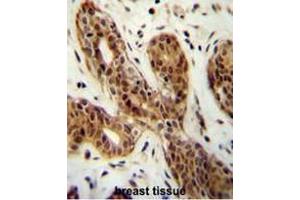 CI150 Antibody (N-term) immunohistochemistry analysis in formalin fixed and paraffin embedded human breast tissue followed by peroxidase conjugation of the secondary antibody and DAB staining. (CI150 anticorps  (N-Term))