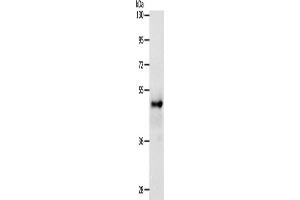 Western Blotting (WB) image for anti-SRY (Sex Determining Region Y)-Box 8 (SOX8) antibody (ABIN2426907)