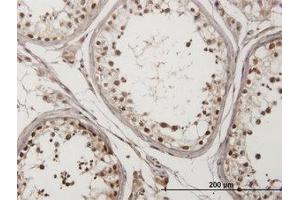 Image no. 1 for anti-Checkpoint Kinase 2 (CHEK2) (AA 1-544) antibody (ABIN599174) (CHEK2 anticorps  (AA 1-544))