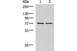 Western blot analysis of Mouse liver tissue and Jurkat cell lysates using MKS1 Polyclonal Antibody at dilution of 1:700