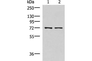 Western blot analysis of Mouse liver tissue and Jurkat cell lysates using MKS1 Polyclonal Antibody at dilution of 1:700 (MKS1 anticorps)
