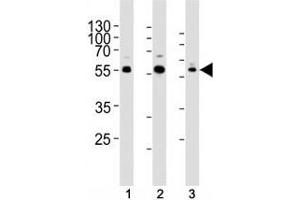 Western blot analysis of lysate from human (1) Jurkat, (2) PC3, and rat (3) C6 cells using AKT1/2/3 antibody at 1:1000. (AKT 1/2/3 anticorps  (AA 278-312))