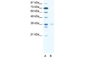 WB Suggested Anti-LHX3 Antibody   Titration: 2. (LHX3 anticorps  (Middle Region))