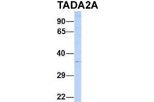 Host:  Rabbit  Target Name:  TADA2A  Sample Type:  721_B  Antibody Dilution:  1. (TADA2L anticorps  (N-Term))