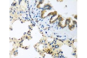 Immunohistochemistry of paraffin-embedded Rat lung using LLGL2 Polyclonal Antibody at dilution of 1:200 (40x lens). (LLGL2 anticorps)