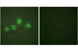 Immunofluorescence analysis of HuvEc cells, using GATA4 (Phospho-Ser262) Antibody. (GATA4 anticorps  (pSer262))
