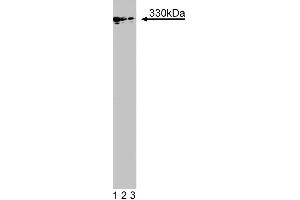 Western blot analysis of MAP1B on a mouse fetus head lysate. (MAP1B anticorps  (AA 1745-1858))
