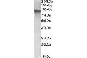 AP23665PU-N TORC2 antibody staining of Jurkat lysate at 1 µg/ml (35 µg protein in RIPA buffer). (CRTC2 anticorps  (C-Term))