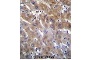 ANKRD18B Antibody (N-term) (ABIN655769 and ABIN2845209) immunohistochemistry analysis in formalin fixed and paraffin embedded human liver tissue followed by peroxidase conjugation of the secondary antibody and DAB staining. (ANKRD18B anticorps  (N-Term))