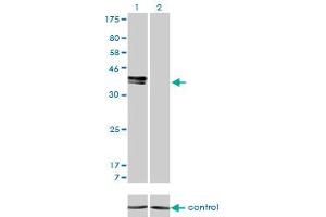 Western blot analysis of ISL1 over-expressed 293 cell line, cotransfected with ISL1 Validated Chimera RNAi (Lane 2) or non-transfected control (Lane 1). (ISL1 anticorps  (AA 63-159))
