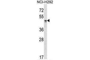 TADA2L Antibody (Center) western blot analysis in NCI-H292 cell line lysates (35µg/lane). (TADA2L anticorps  (Middle Region))