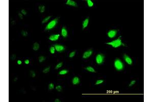 Immunofluorescence of monoclonal antibody to PSMC2 on HeLa cell.