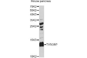 Western blot analysis of extracts of mouse pancreas, using TYROBP antibody (ABIN6291980) at 1:3000 dilution.