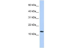 WB Suggested Anti-FAM14A Antibody Titration:  0. (IFI27L2 anticorps  (Middle Region))