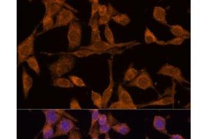 Immunofluorescence analysis of HeLa cells using USP15 Polyclonal Antibody at dilution of 1:100 (40x lens). (USP15 anticorps)