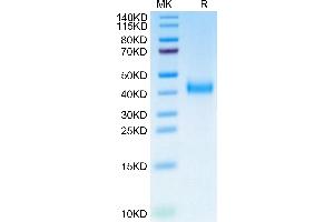 Biotinylated Cynomolgus IL-2 R beta on Tris-Bis PAGE under reduced condition.