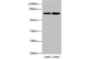 Western blot All lanes: SLC23A2antibody at 3. (SLC23A2 anticorps  (AA 1-90))