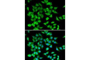 Immunofluorescence analysis of HeLa cells using NFATC3 antibody.