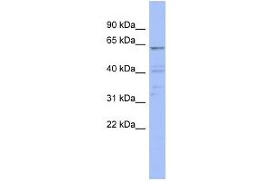 WB Suggested Anti-ZNF689 Antibody Titration:  0. (ZNF689 anticorps  (N-Term))
