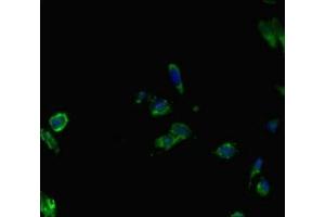 Immunofluorescent analysis of Hela cells using ABIN7145087 at dilution of 1:100 and Alexa Fluor 488-congugated AffiniPure Goat Anti-Rabbit IgG(H+L) (AIRE anticorps  (AA 39-108))