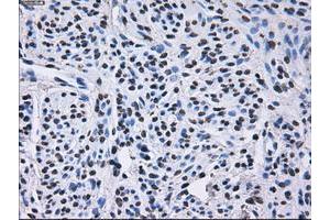 Image no. 11 for anti-Replication Protein A2, 32kDa (RPA2) antibody (ABIN1500735) (RPA2 anticorps)