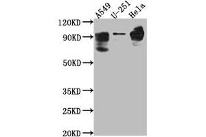 Western Blot Positive WB detected in: THP-1 whole cell lysate All lanes: PDE4D antibody at 1:1000 Secondary Goat polyclonal to rabbit IgG at 1/50000 dilution Predicted band size: 92, 77, 69, 67, 58, 85, 24, 60, 78, 77, 85, 25 kDa Observed band size: 92 kDa (Recombinant PDE4D anticorps)