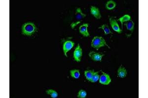 Immunofluorescent analysis of MCF-7 cells using ABIN7170036 at dilution of 1:100 and Alexa Fluor 488-congugated AffiniPure Goat Anti-Rabbit IgG(H+L)