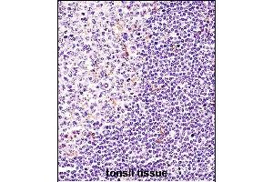 BTK Antibody (N-term) (ABIN657469 and ABIN2846497) immunohistochemistry analysis in formalin fixed and paraffin embedded human tonsil tissue followed by peroxidase conjugation of the secondary antibody and DAB staining.