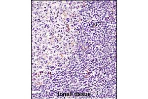 BTK Antibody (N-term) (ABIN657469 and ABIN2846497) immunohistochemistry analysis in formalin fixed and paraffin embedded human tonsil tissue followed by peroxidase conjugation of the secondary antibody and DAB staining. (BTK anticorps  (N-Term))
