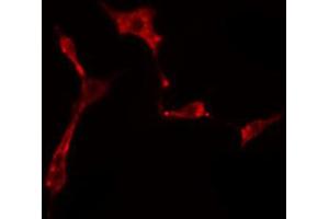 ABIN6274500 staining HeLa cells by IF/ICC. (ZNF436 anticorps  (C-Term))
