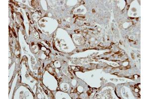 IHC-P Image Immunohistochemical analysis of paraffin-embedded NCIN87 xenograft, using Collagen III alpha1, antibody at 1:500 dilution.