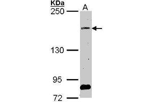 WB Image Sample (30 ug of whole cell lysate) A: A549 5% SDS PAGE antibody diluted at 1:1000 (SOS2 anticorps  (Center))