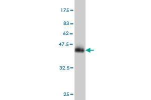 Western Blot detection against Immunogen (42. (MTAP anticorps  (AA 1-154))
