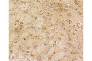 Immunohistochemistry of paraffin-embedded mouse brain using ARRB1 antibody (ABIN4903044) at dilution of 1:100 (40x lens). (beta Arrestin 1 anticorps)