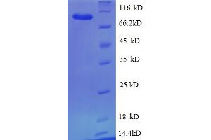 SDS-PAGE (SDS) image for Heat Shock Protein 90kDa beta (Grp94), Member 1 (HSP90B1) (AA 27-799), (partial) protein (His tag) (ABIN5712762)