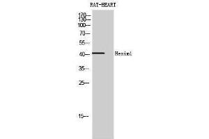 Western Blotting (WB) image for anti-Hexamethylene Bis-Acetamide Inducible 1 (HEXIM1) (Internal Region) antibody (ABIN3175479) (HEXIM1 anticorps  (Internal Region))