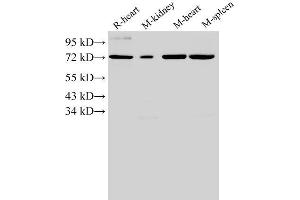 Western Blotting (WB) image for anti-Annexin A6 (ANXA6) antibody (ABIN7234042) (ANXA6 anticorps)