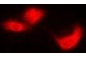 Immunofluorescent analysis of EIF6 staining in Hela cells.