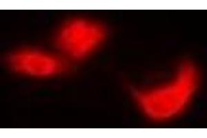 Immunofluorescent analysis of EIF6 staining in Hela cells. (EIF6 anticorps)