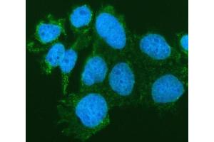 IF analysis of SIAE using anti-SIAE antibody (ABIN7600774). (SIAE anticorps  (AA 230-523))