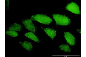 Immunofluorescence of purified MaxPab antibody to CASP3 on HeLa cell.