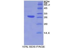 SDS-PAGE analysis of Mouse TOR1AIP2 Protein. (TOR1AIP2 Protéine)